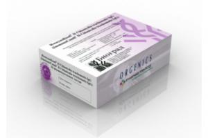 ИммуноКомб® Dengue IgM & IgG БиСпот