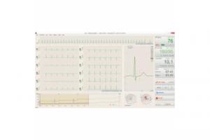 Компьютеризированная стресс-тест система - версия программного обеспечения  BTL CardioPoint-Ergo E600 