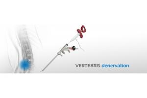 VERTEBRIS denervation