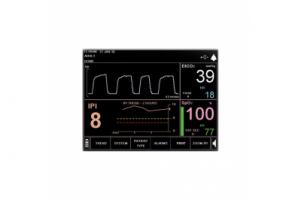 Алгоритм Capnography