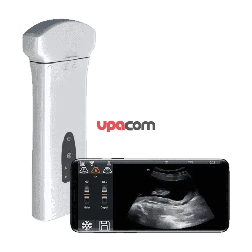 Delta D8 беспроводной УЗИ-аппарат